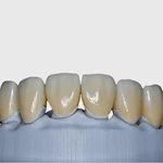 3D-Pro-ML