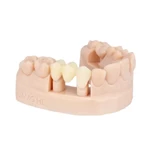 Dental Temporary Corwn & Bridge Resin